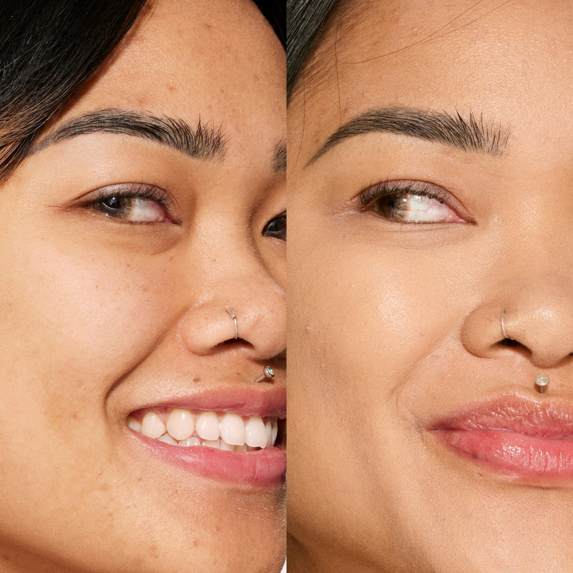 A person's face before and after using Tower 28 Beauty's Swipe Serum Concealer in shade 10.0 NOHO to cover up dark circles, blemishes, and discoloration