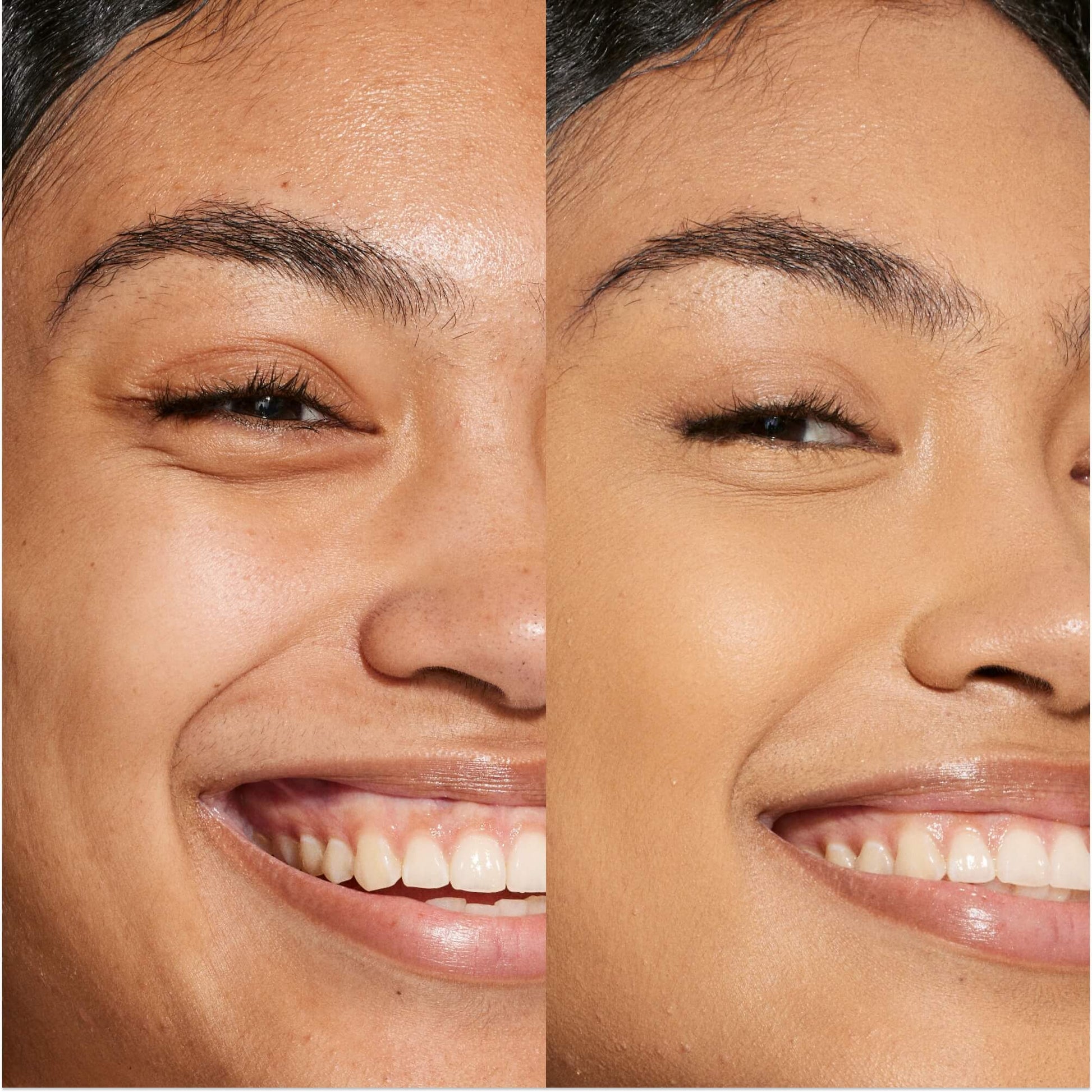 A person's face before and after using Tower 28 Beauty's Swipe Serum Concealer in shade 11.0 OC to cover up dark circles, blemishes, and discoloration