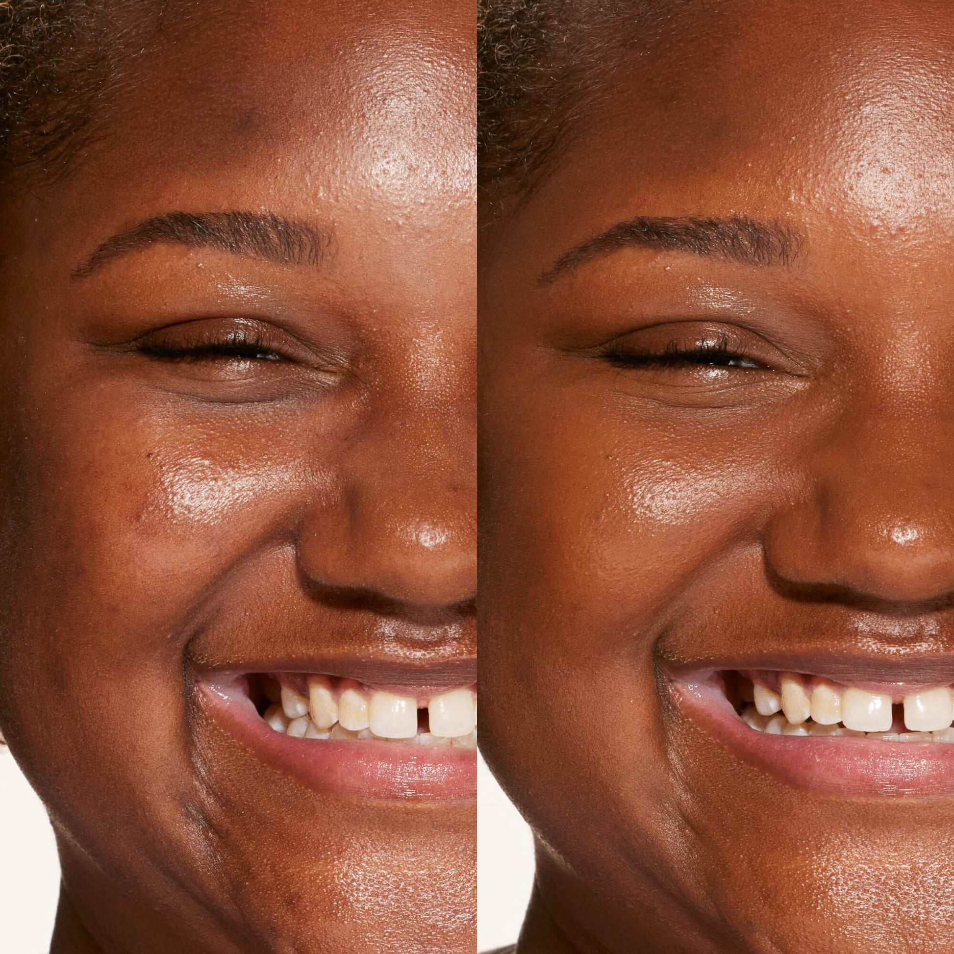 A person's face before and after using Tower 28 Beauty's Swipe Serum Concealer in shade 19.0 WEHO to cover up dark circles, blemishes, and discoloration