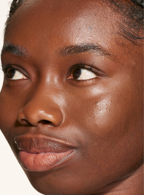 [A person's face with an evened out complexion after using Tower 28 Beauty's Swipe Serum Concealer in shade 20%]
