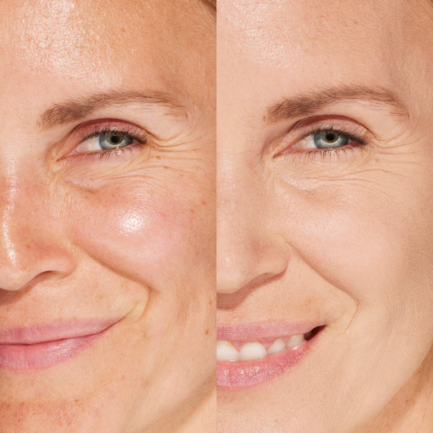 6.0 IE [A person's face before and after using Tower 28 Beauty's Swipe Serum Concealer in shade 6.0 IE to cover up dark circles, blemishes, and discoloration]