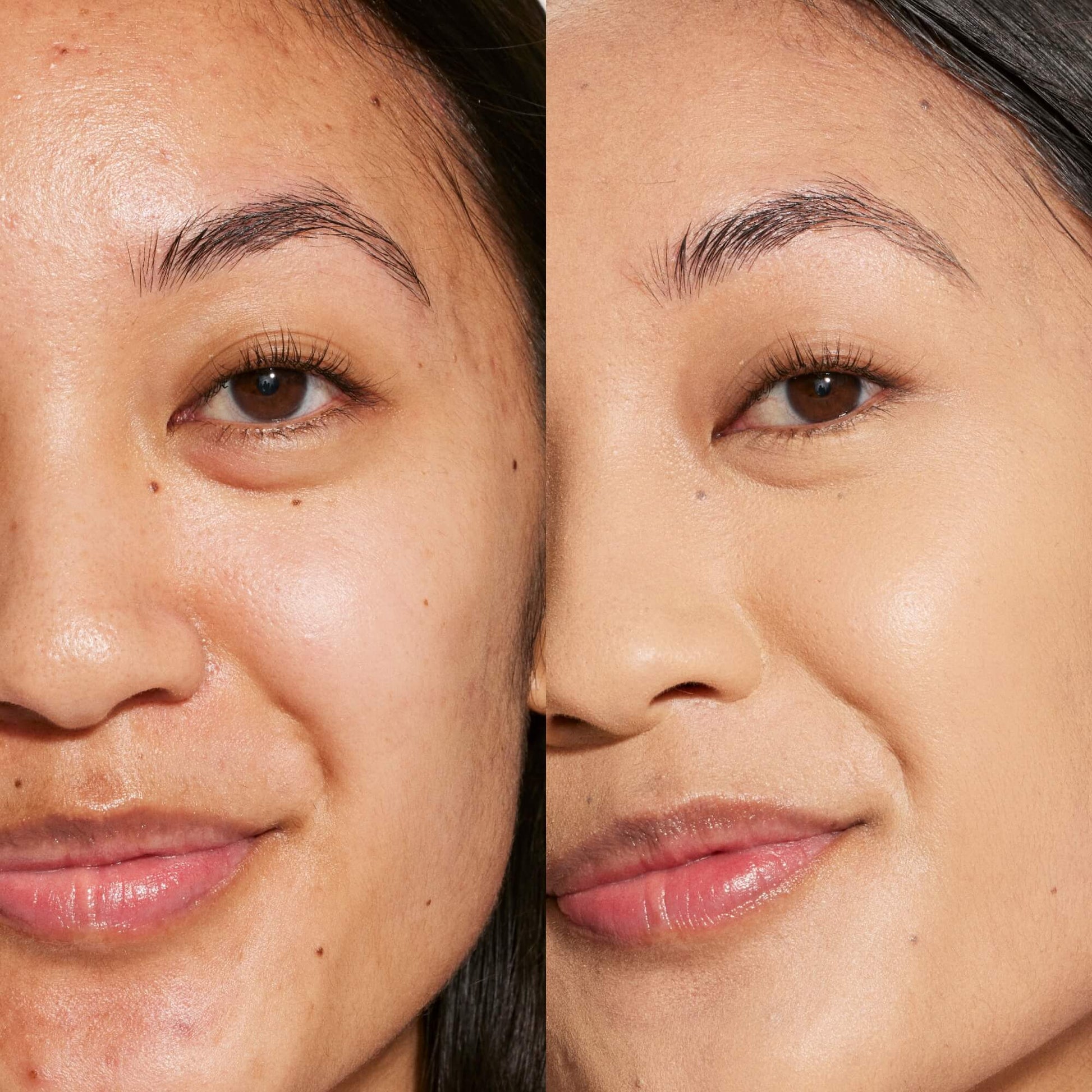 A person's face before and after using Tower 28 Beauty's Swipe Serum Concealer in shade 8.0 LBC to cover up dark circles, blemishes, and discoloration