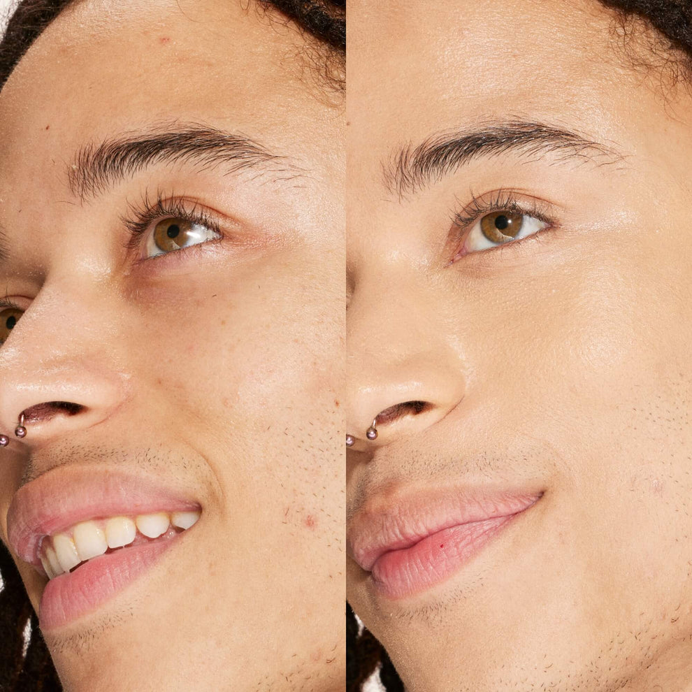 A person's face before and after using Tower 28 Beauty's Swipe Serum Concealer in shade 9.0 MDR to cover up dark circles, blemishes, and discoloration