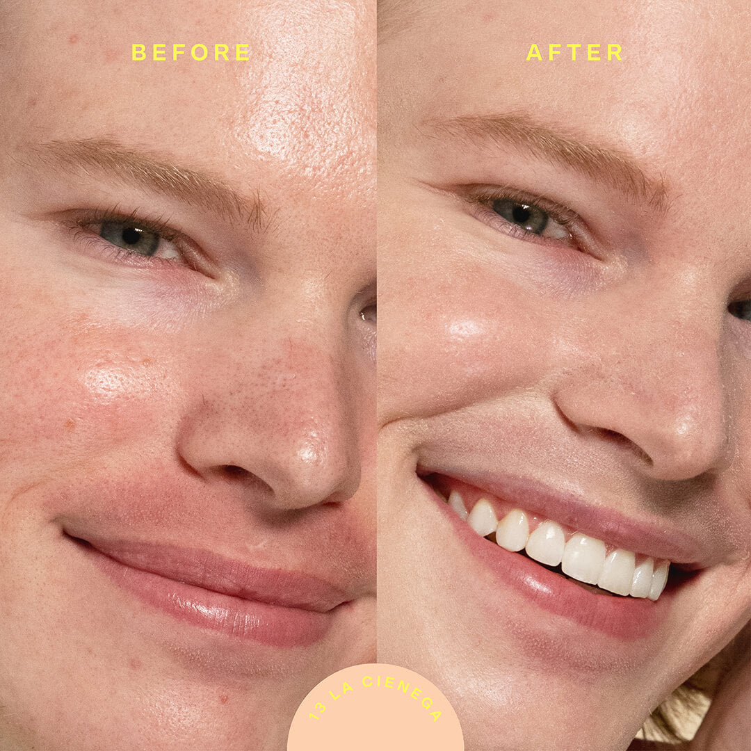 A model before (left image) and after (right image) applyingTower 28 Beauty SunnyDays™ Tinted SPF 30 in the shade 13 La Cienega