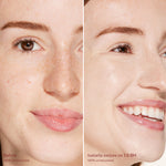 Before and after comparison of a woman's face with visible skin texture improvement. [1.0 BH]