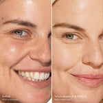 Before and after comparison of a woman's smile with concealer after [4.0 DTLA]