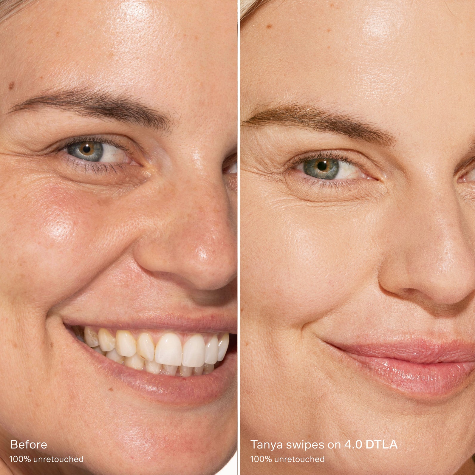 Before and after comparison of a woman's smile with concealer after [4.0 DTLA]