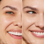 Before and after comparison of a woman's smile [5.0 EP]