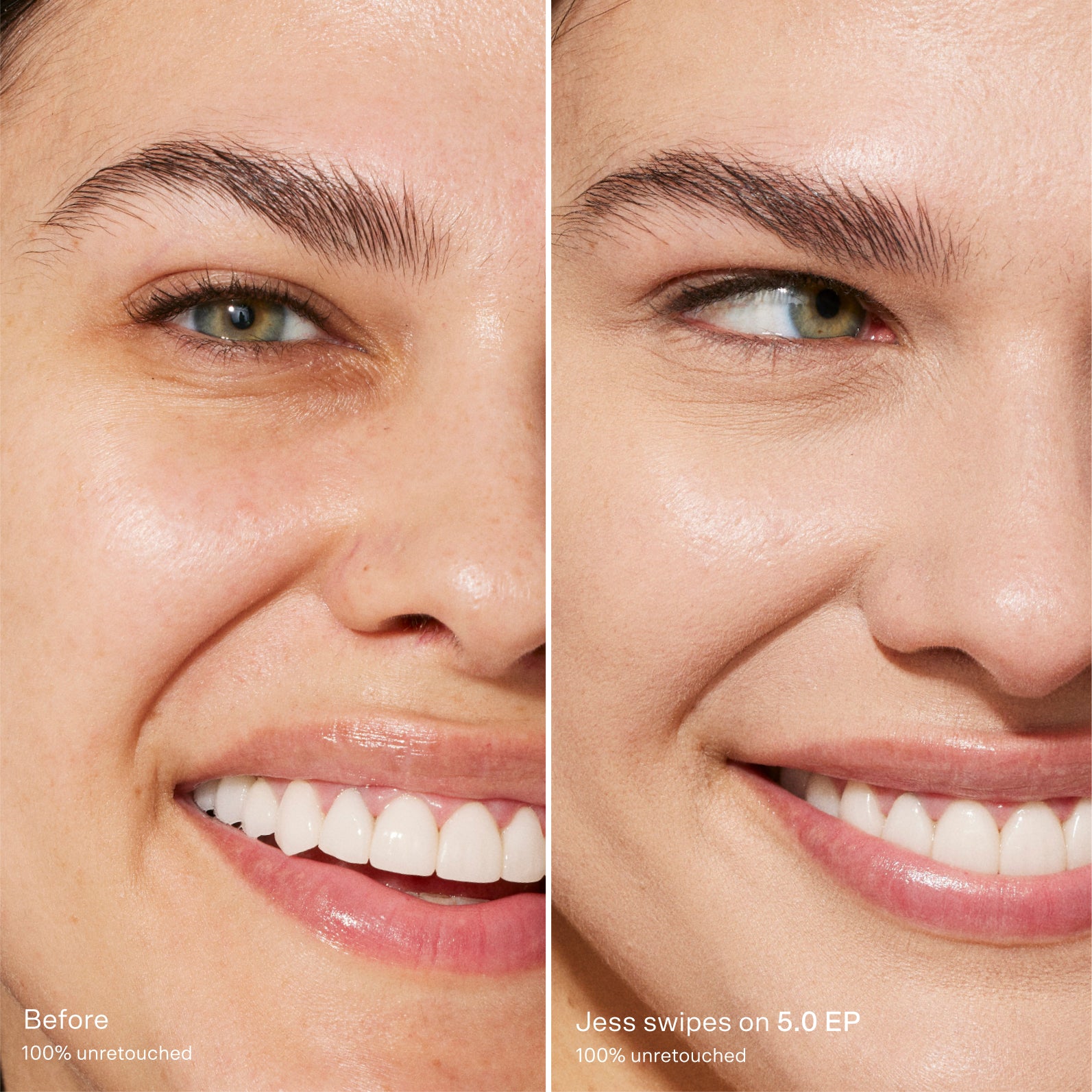 Before and after comparison of a woman's smile [5.0 EP]