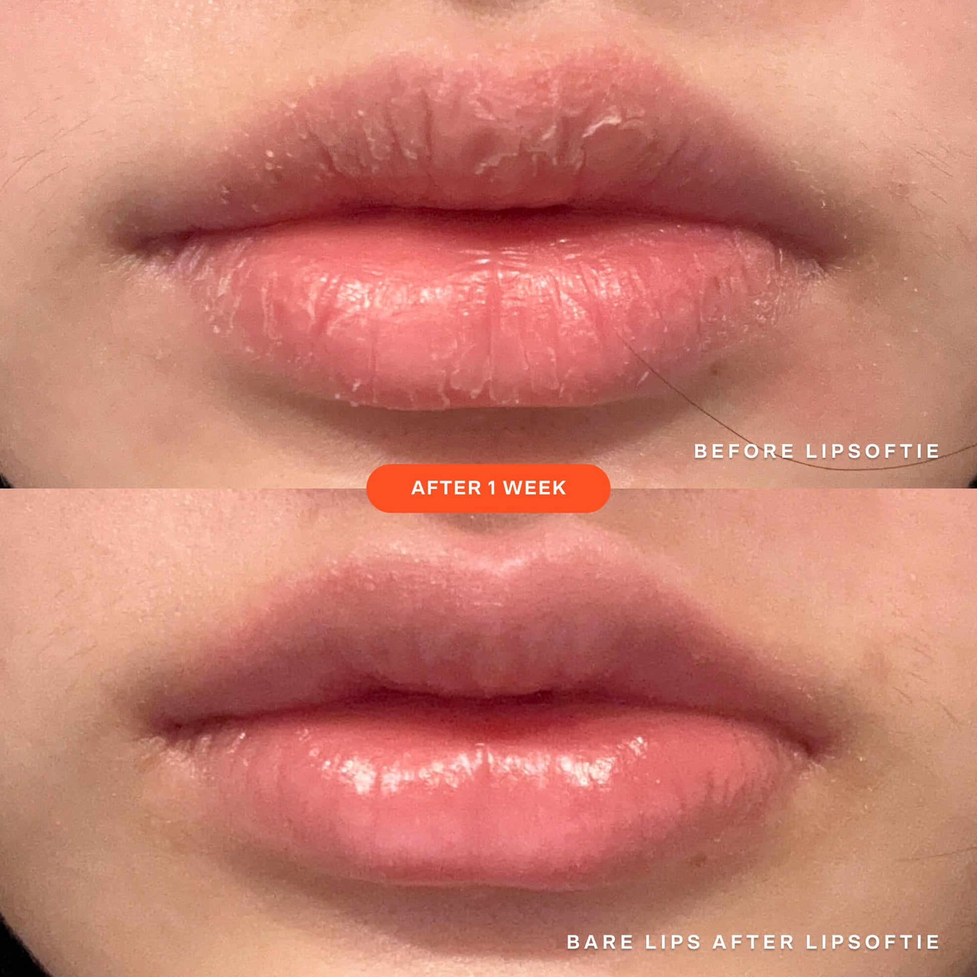 [A before and after image of the same lips showcasing the effectiveness of Tower 28 Beauty's LipSoftie™ Lip Treatment in SOS Vanilla after one week of use