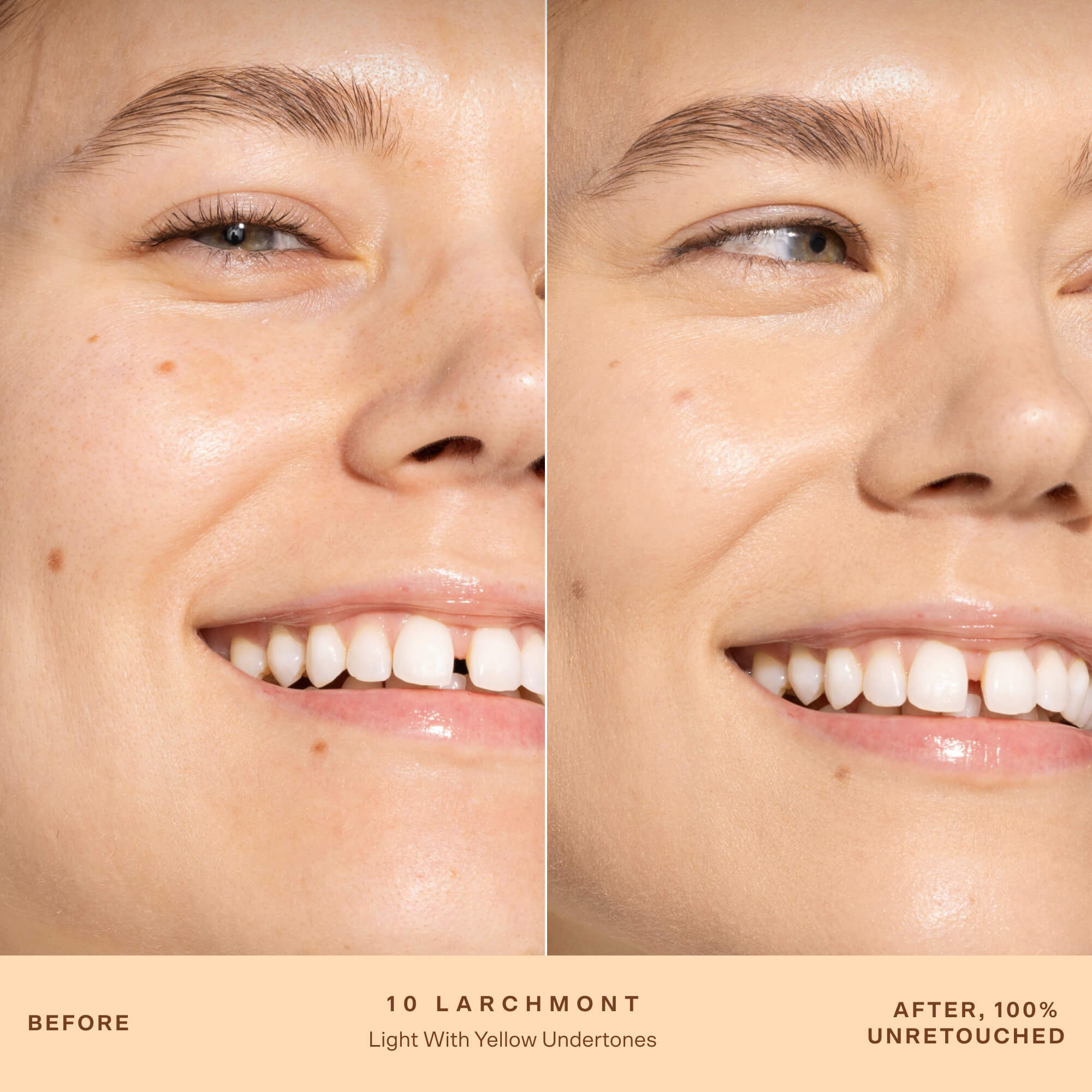 A person's face before and after applying SunnyDays™ Tinted SPF 30 in the shade 10 Larchmont, revealing sheer, buildable coverage that visibly evens skin tone and softens discoloration while maintaining a natural, skin-like finish. [10 Larchmont]