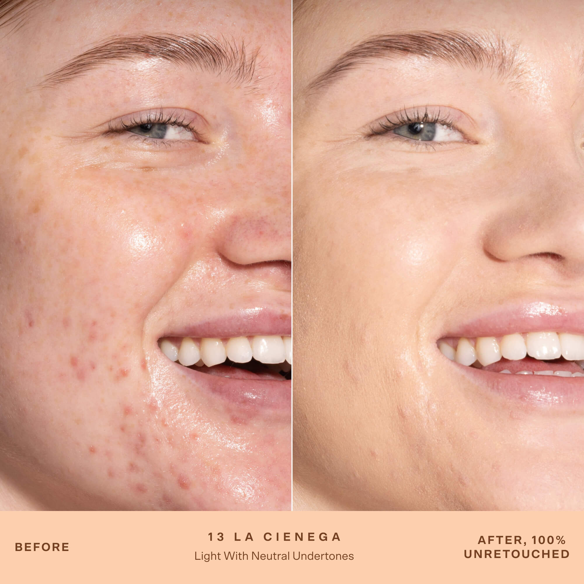 A person's face before and after applying SunnyDays™ Tinted SPF 30 in the shade 13 La Cienega, revealing sheer, buildable coverage that visibly evens skin tone and softens discoloration while maintaining a natural, skin-like finish. [13 La Cienega]