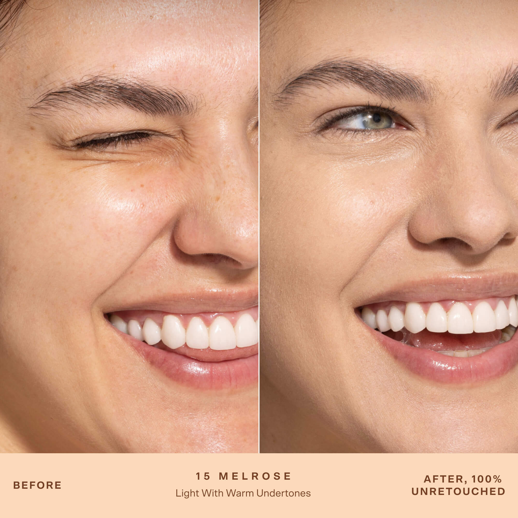 A person's face before and after applying SunnyDays™ Tinted SPF 30 in the shade 15 Melrose, revealing sheer, buildable coverage that visibly evens skin tone and softens discoloration while maintaining a natural, skin-like finish. [15 Melrose]
