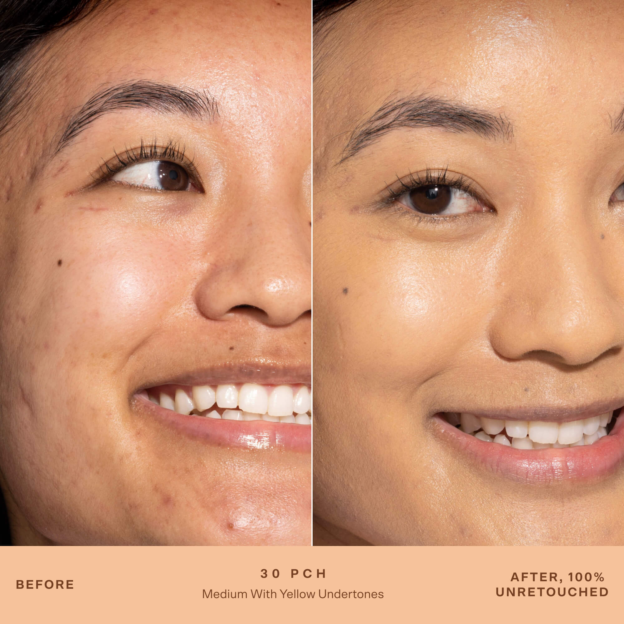 A person's face before and after applying SunnyDays™ Tinted SPF 30 in the shade 30 PCH, revealing sheer, buildable coverage that visibly evens skin tone and softens discoloration while maintaining a natural, skin-like finish. [30 PCH]