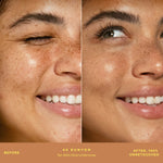 A person's face before and after applying SunnyDays™ Tinted SPF 30 in the shade 40 Runyon, revealing sheer, buildable coverage that visibly evens skin tone and softens discoloration while maintaining a natural, skin-like finish. [40 Runyon]