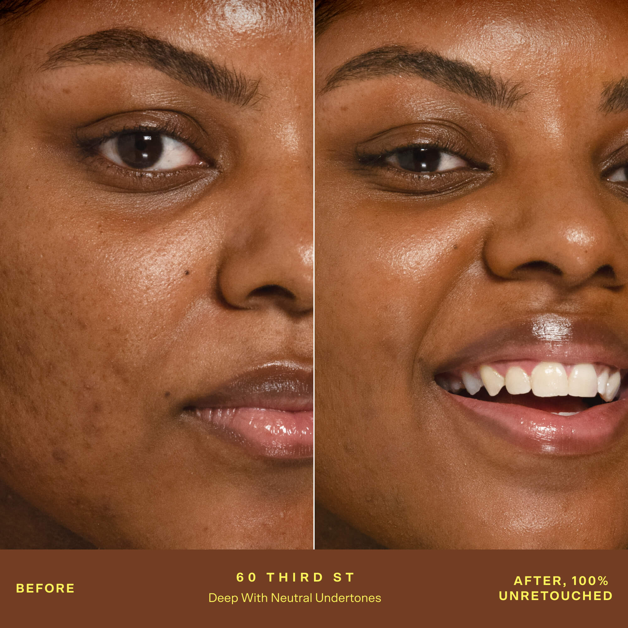 A person's face before and after applying SunnyDays™ Tinted SPF 30 in the shade 60 Third St, revealing sheer, buildable coverage that visibly evens skin tone and softens discoloration while maintaining a natural, skin-like finish. [60 Third St]