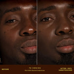 A person's face before and after applying SunnyDays™ Tinted SPF 30 in the shade 70 Venice, revealing sheer, buildable coverage that visibly evens skin tone and softens discoloration while maintaining a natural, skin-like finish. [70 Venice]