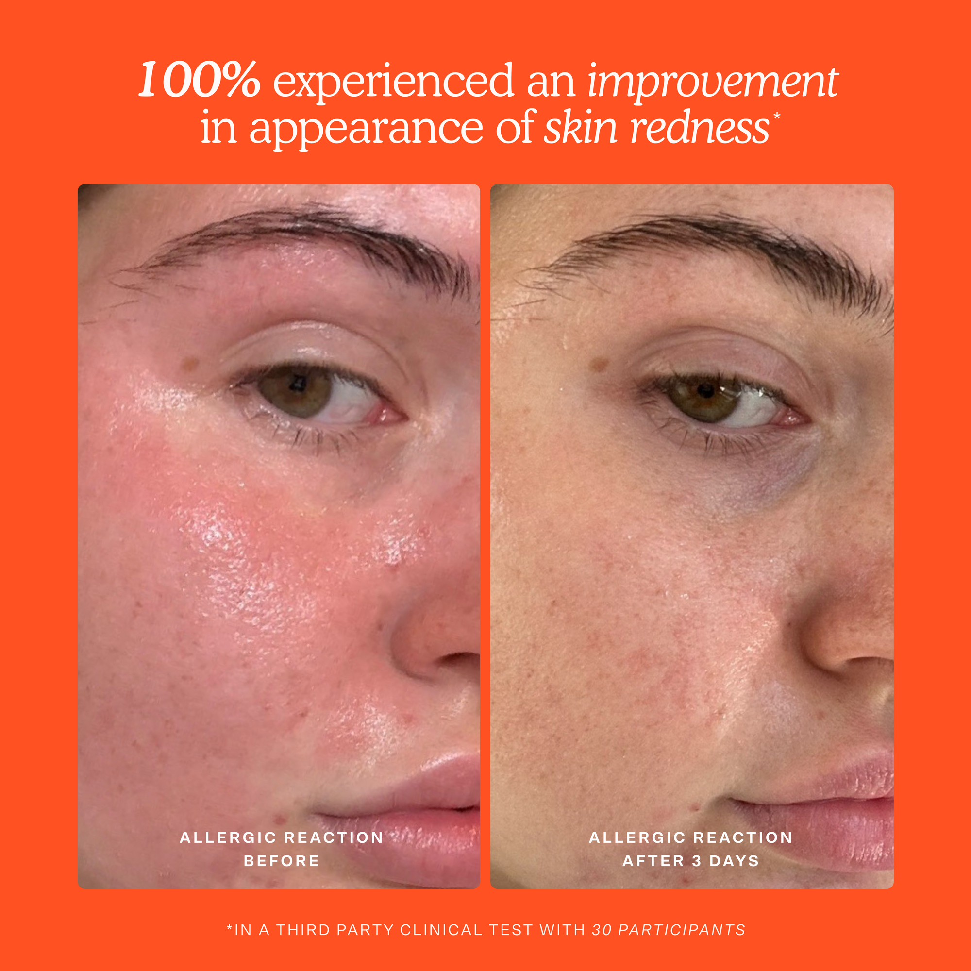 Before and after comparison of skin with blemishes on an orange background [Shared]