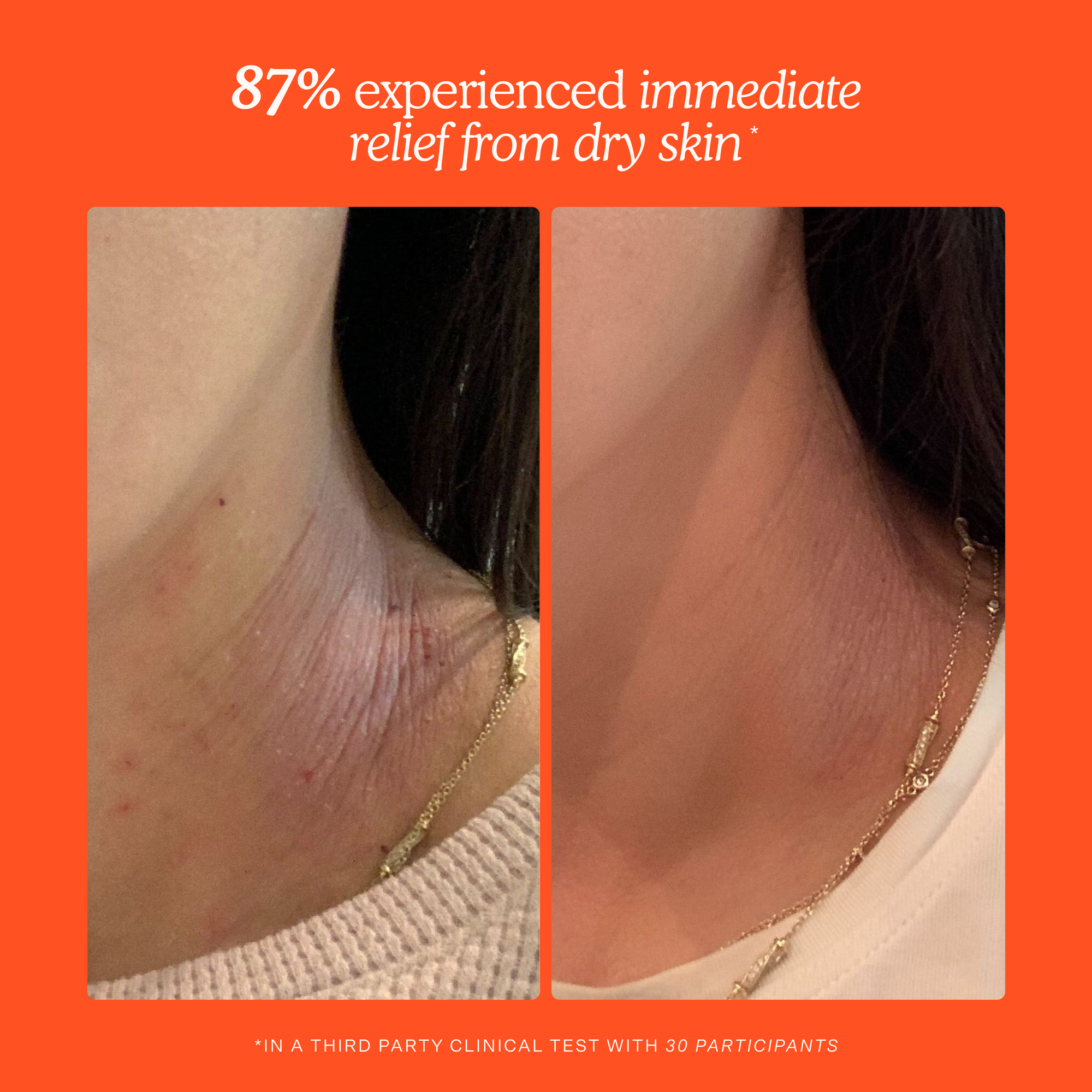 Before and after comparison of skin with blemishes on an orange background [Shared]