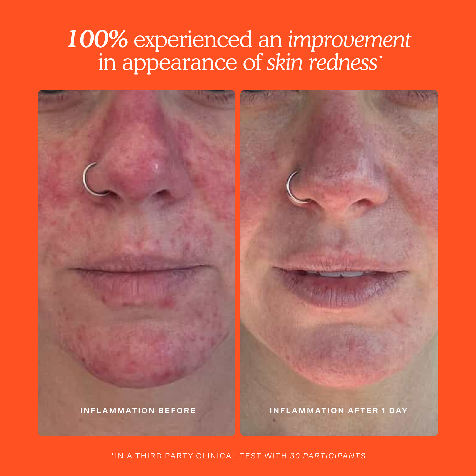 Before and after comparison of skin with blemishes on an orange background [Shared]