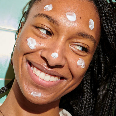 A person with Tower 28 Beauty’s SOS Daily Barrier Recovery Cream applied across their forehead, cheeks, nose, and chin. [Standard]