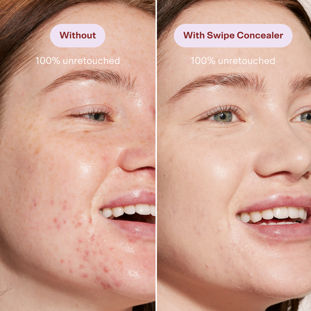 [A close up of a model before (left image) and after (right image) applying Swipe Serum Concealer on her redness and texture.] 