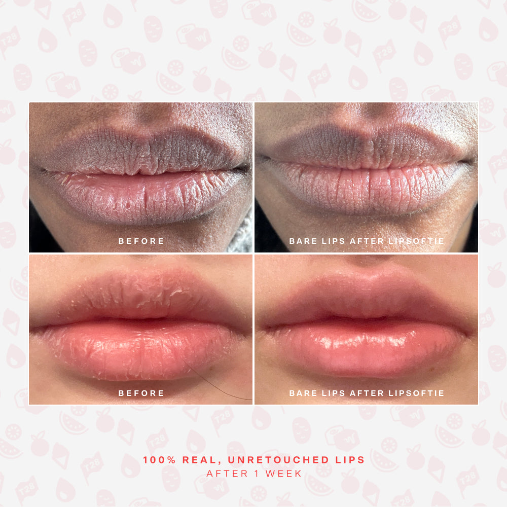 [Shared: Before and after photos of 2 different lips showing the hydrating effects of Tower 28 Beauty LipSoftie™ Lip Treatment]