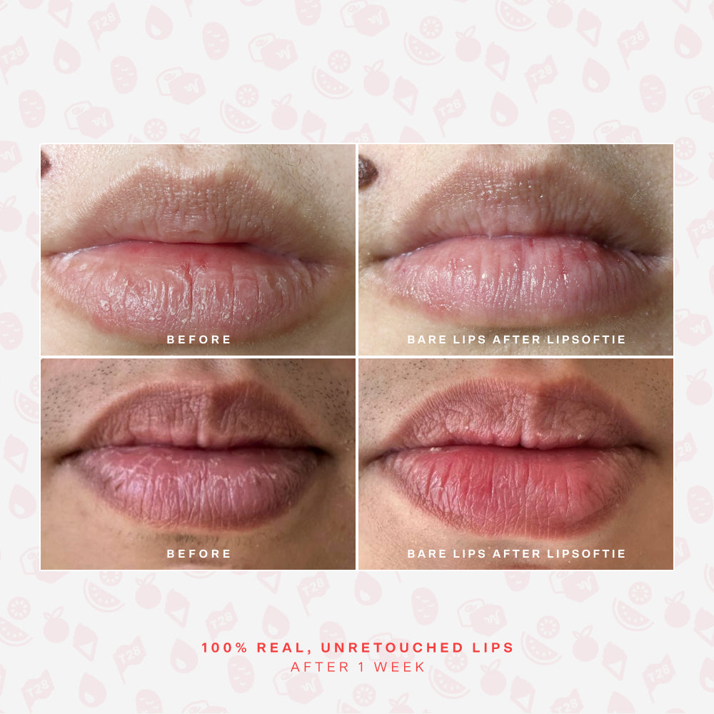 [Shared: Before and after photos of 2 different lips showing the hydrating effects of Tower 28 Beauty LipSoftie™ Lip Treatment