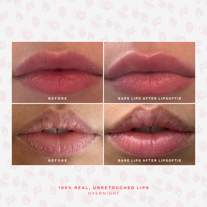 [Shared: Before and after photos of 2 different lips showing the hydrating effects of Tower 28 Beauty LipSoftie™ Lip Treatment]