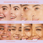 Collage of faces with text highlighting product benefits for sensitive skin. [Shared]