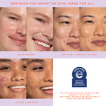 Product advertisement showing faces with different skin conditions and a National Eczema Association logo. [Shared]