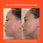 Before and after comparison of a person's face with eczema, showing improvement after 2 weeks on an orange background. [Shared]