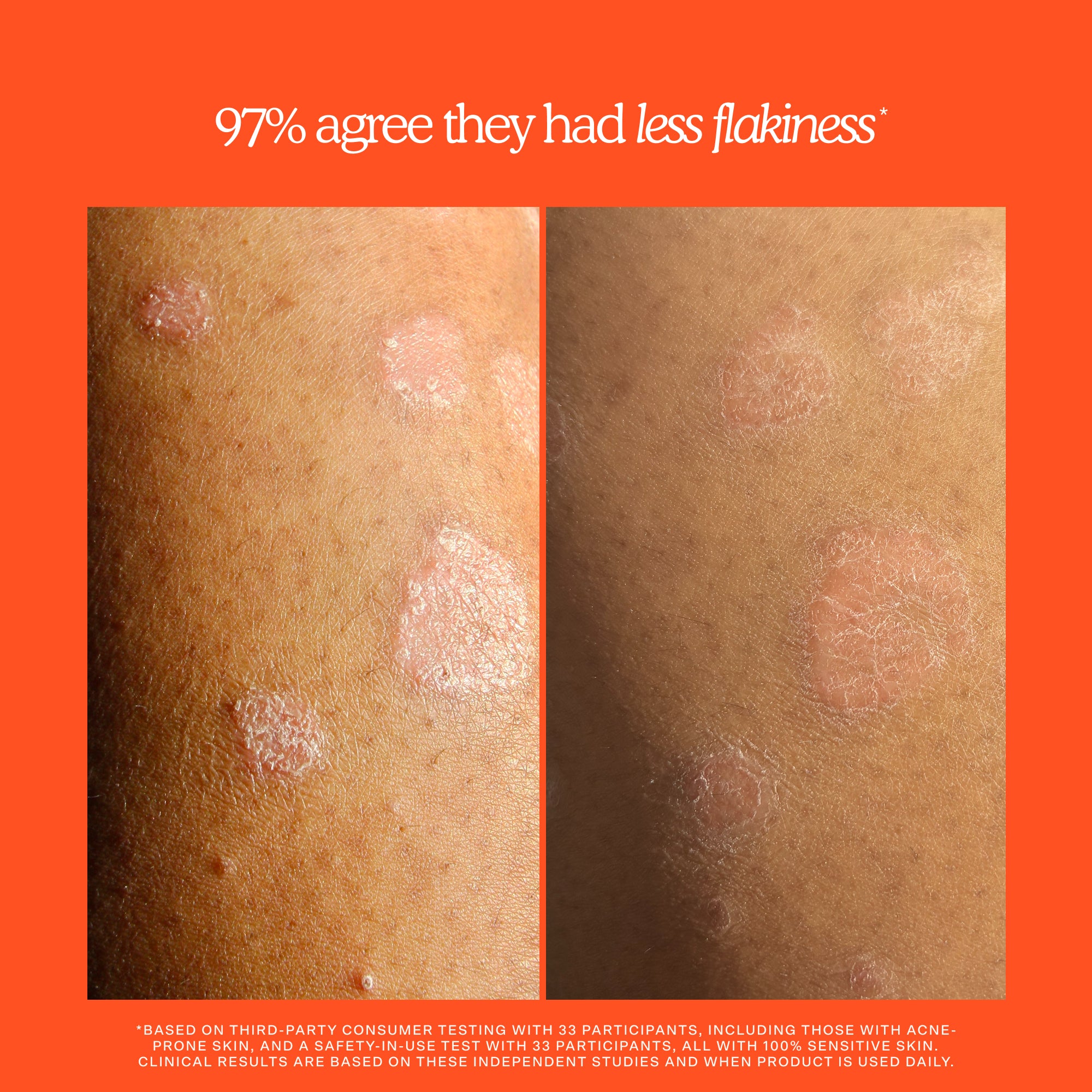 SOS Rescue + Relief Body Wash Treatment