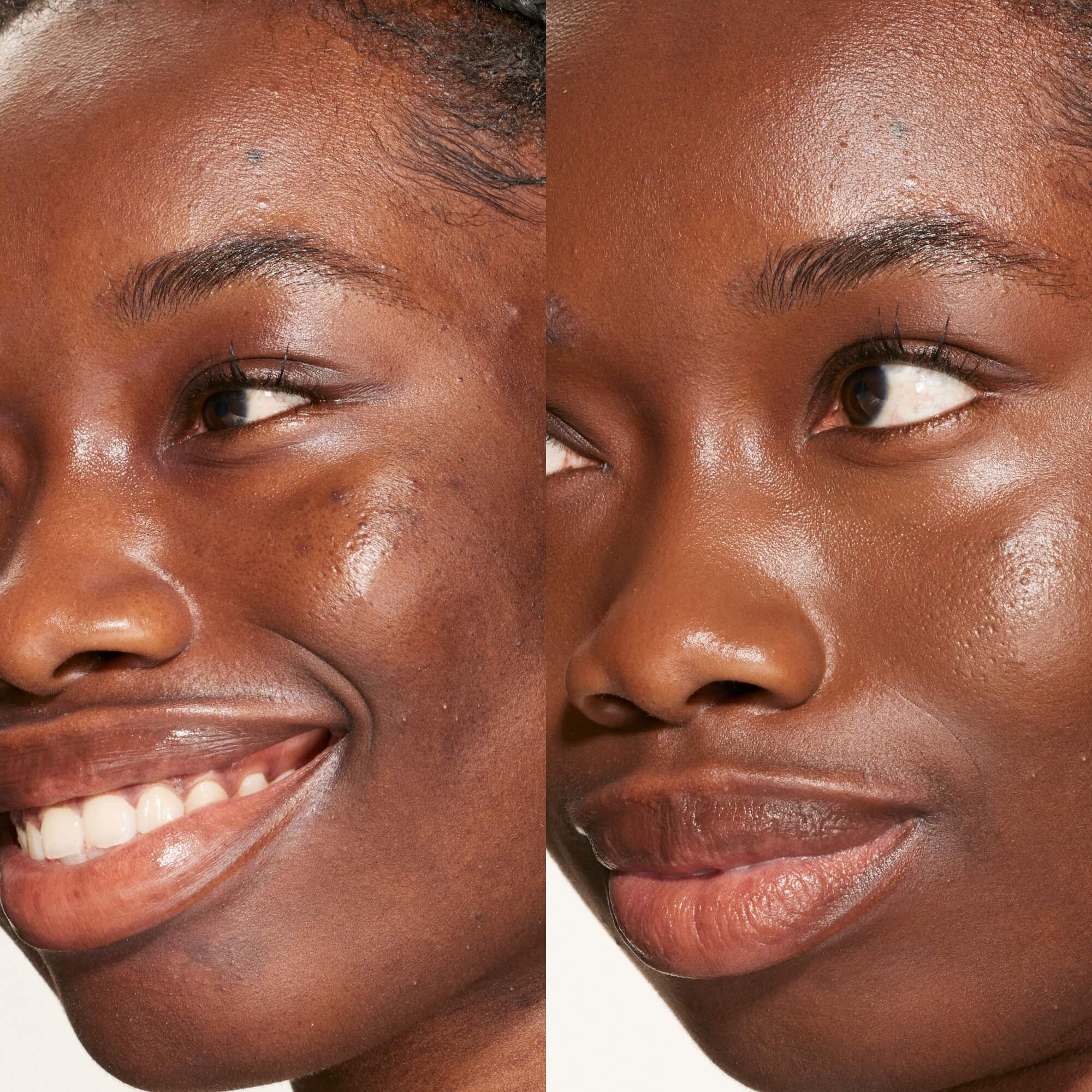 A person's face before and after using Tower 28 Beauty's Swipe Serum Concealer in shade 20.0 WLA to cover up dark circles, blemishes, and discoloration. [20.0 WLA]