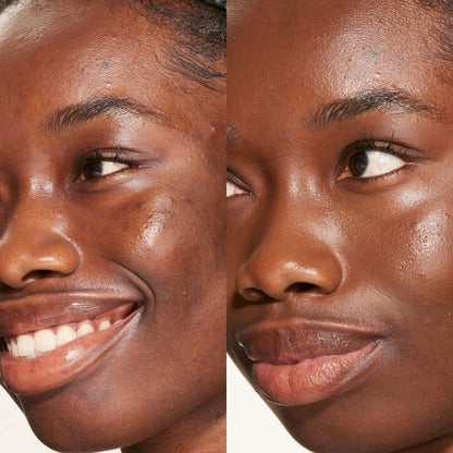 20.0 WLA [A person's face before and after using Tower 28 Beauty's Swipe Serum Concealer in shade 20.0 WLA to cover up dark circles, blemishes, and discoloration]