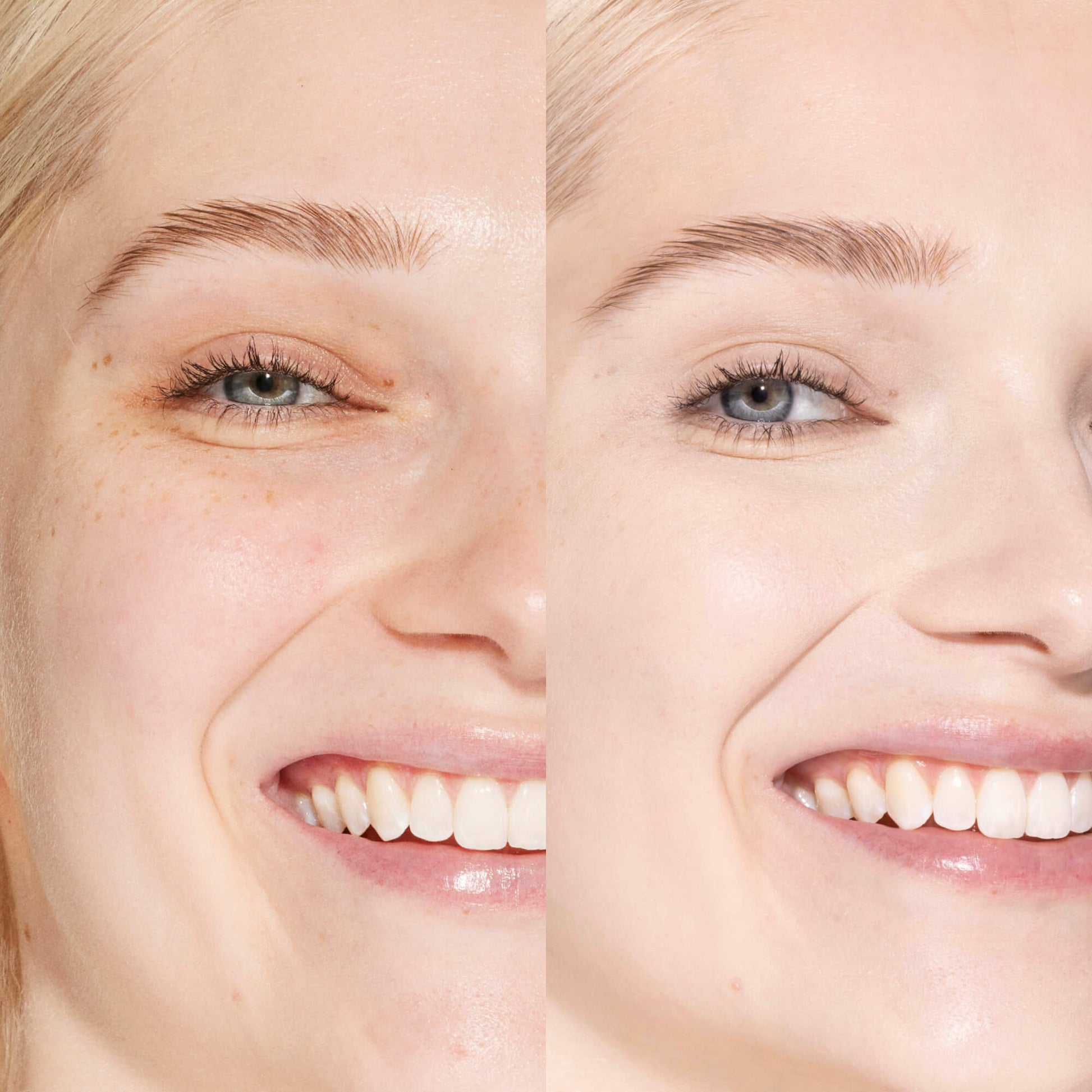 A person's face before and after using Tower 28 Beauty's Swipe Serum Concealer in shade 1.0 BH to cover up dark circles, blemishes, and discoloration