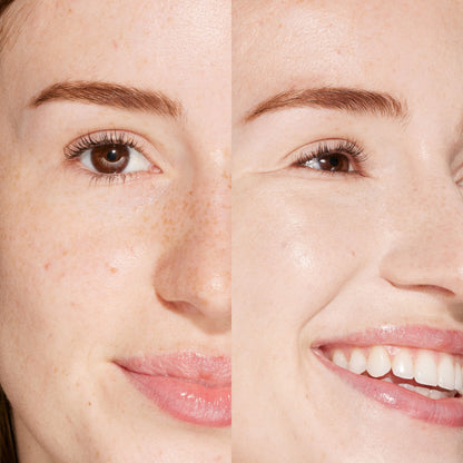 1.0 BH [A person's face before and after using Tower 28 Beauty's Swipe Serum Concealer in shade 1.0 BH to cover up dark circles, blemishes, and discoloration]