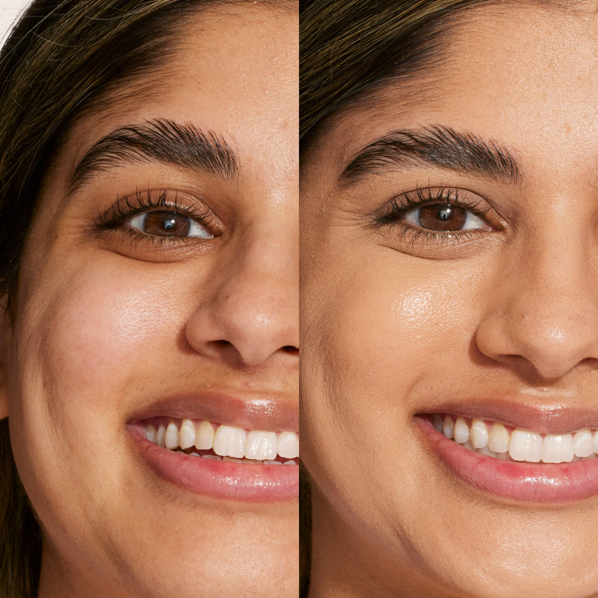 A person's face before and after using Tower 28 Beauty's Swipe Serum Concealer in shade 10.0 NOHO, showing softened dark circles, a smoother skin texture, and a more even complexion. [10.0 NOHO]