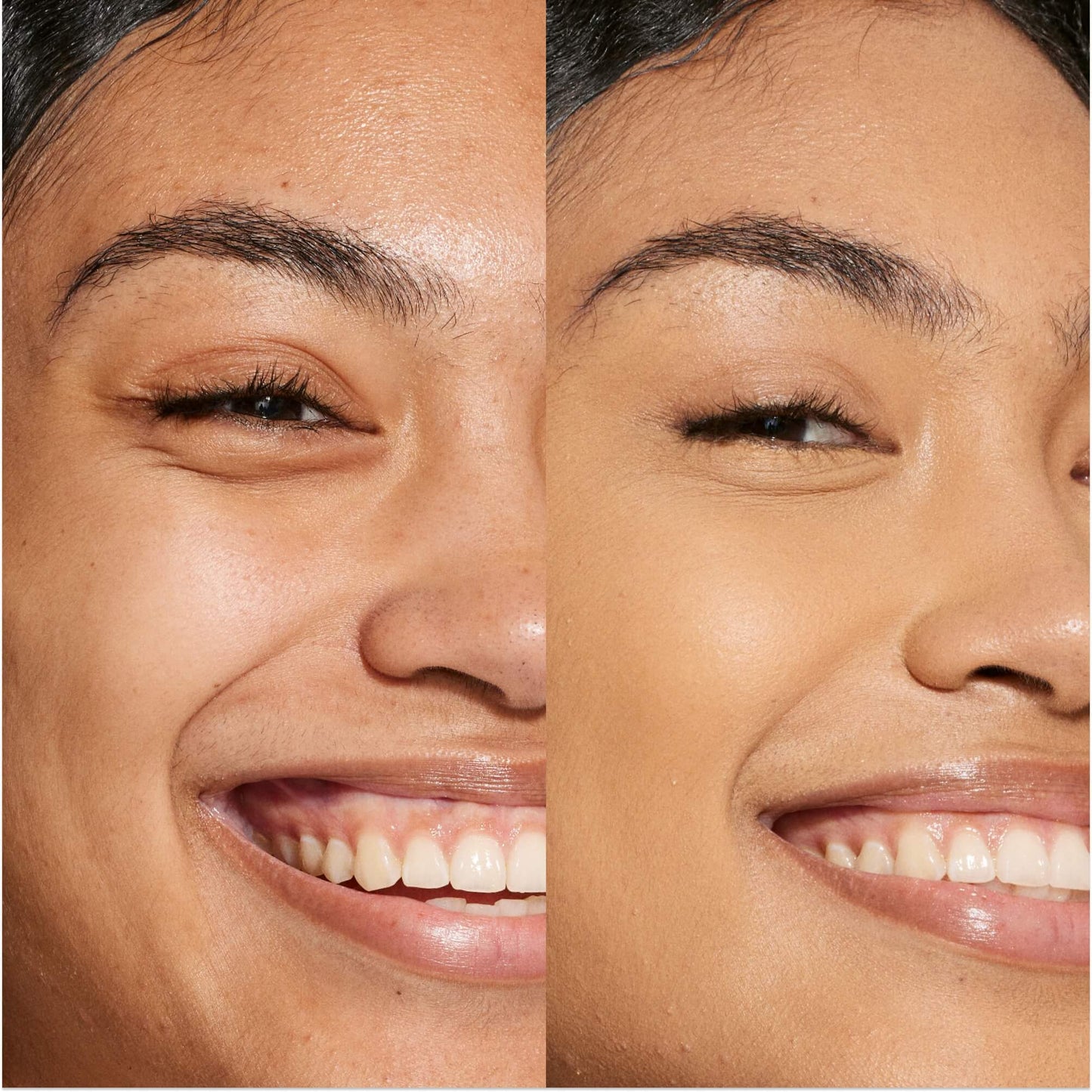 11.0 OC [A person's face before and after using Tower 28 Beauty's Swipe Serum Concealer in shade 11.0 OC to cover up dark circles, blemishes, and discoloration]