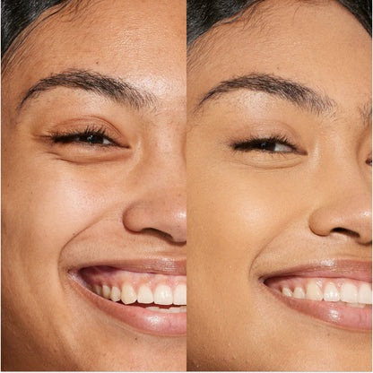 11.0 OC [A person's face before and after using Tower 28 Beauty's Swipe Serum Concealer in shade 11.0 OC to cover up dark circles, blemishes, and discoloration]