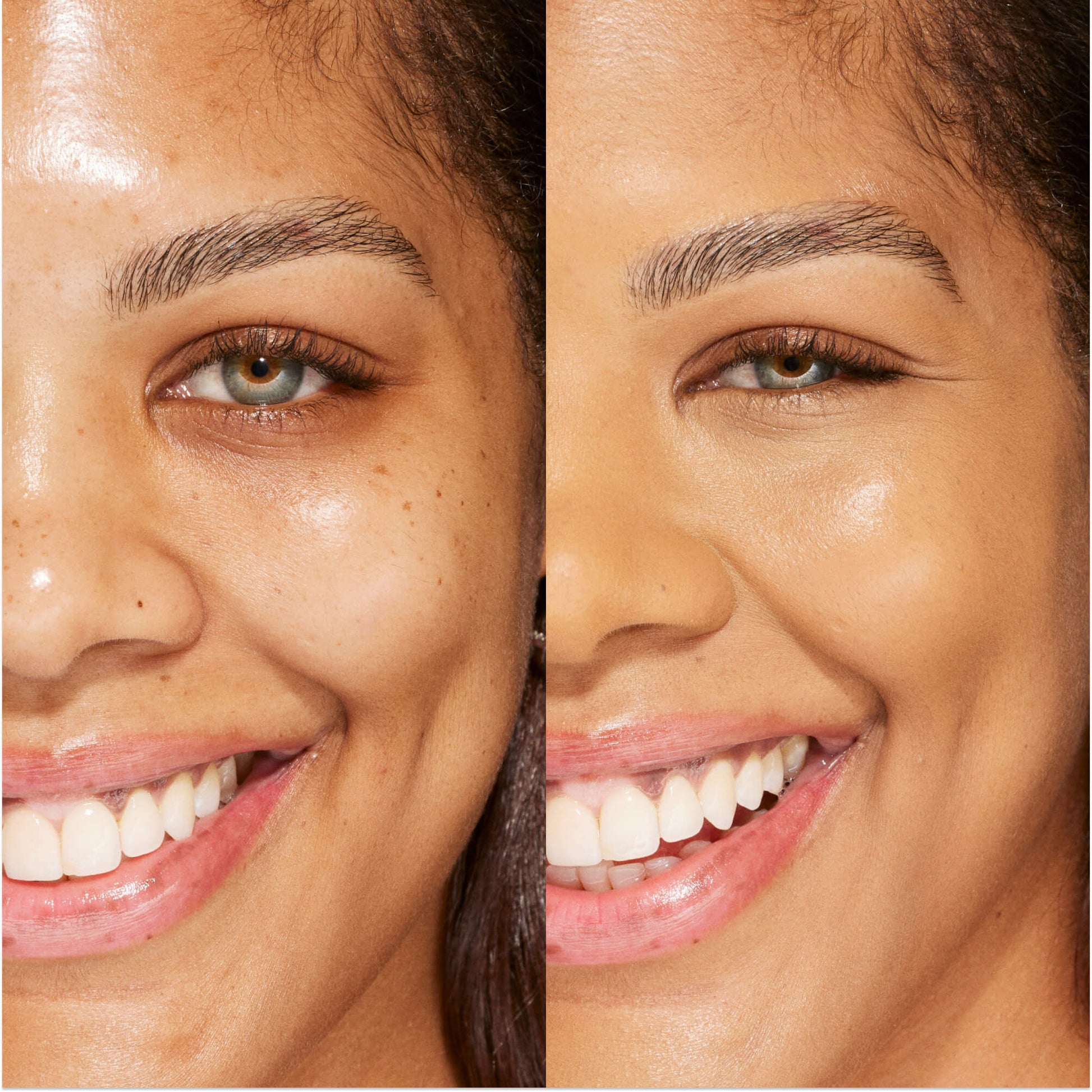 A person's face before and after using Tower 28 Beauty's Swipe Serum Concealer in shade 12.0 PALI to cover up dark circles, blemishes, and discoloration