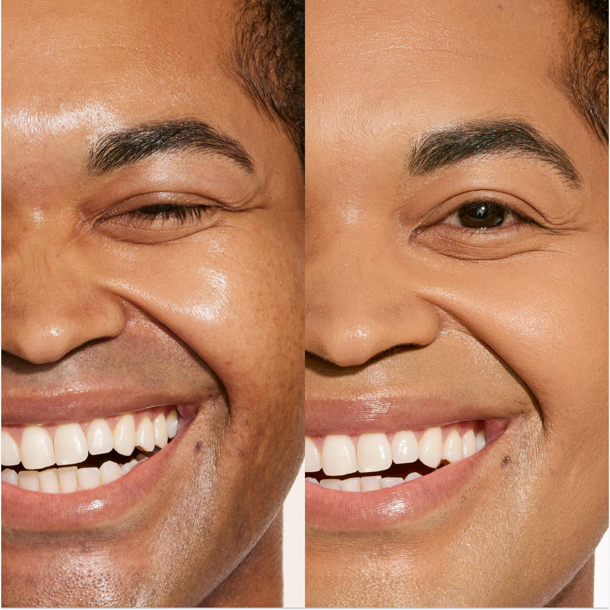 A person shown wearing Tower 28 Beauty's Swipe Serum Concealer in 13.0 PLAYA, with visibly evened skin tone, brightened under-eyes, and smooth, natural finish. [13.0 PLAYA]