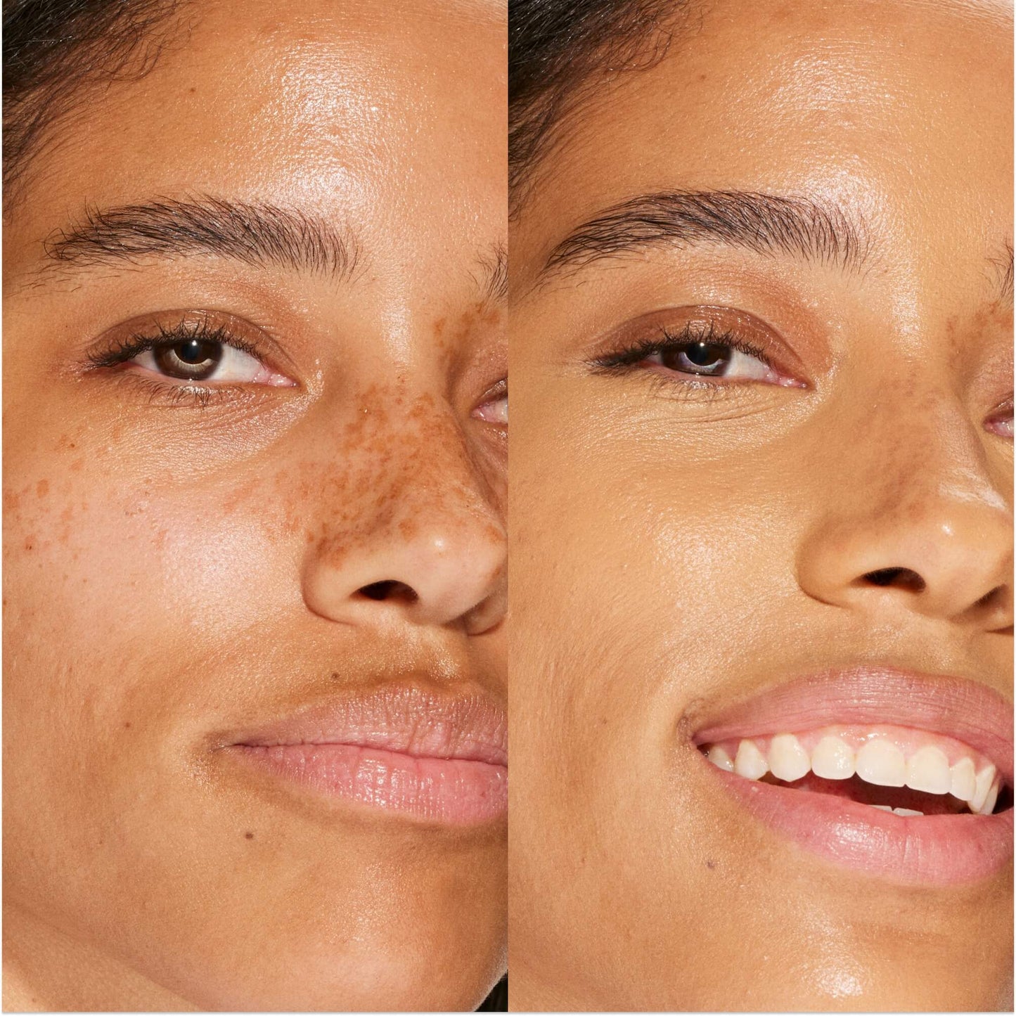 13.0 PLAYA [A person's face before and after using Tower 28 Beauty's Swipe Serum Concealer in shade 13.0 PLAYA to cover up dark circles, blemishes, and discoloration]