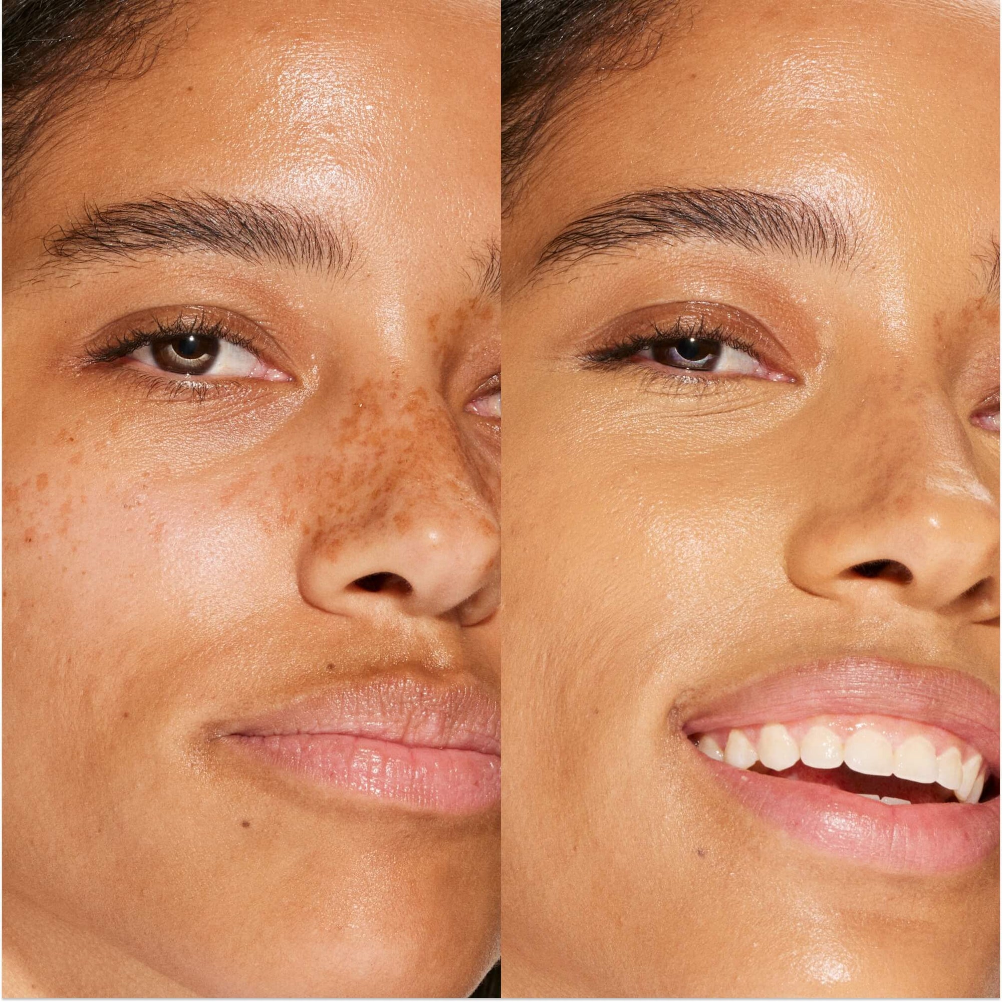 A person's face before and after using Tower 28 Beauty's Swipe Serum Concealer in 13.0 PLAYA, shown with visibly evened skin tone, blurred texture, and a soft matte finish. [13.0 PLAYA]