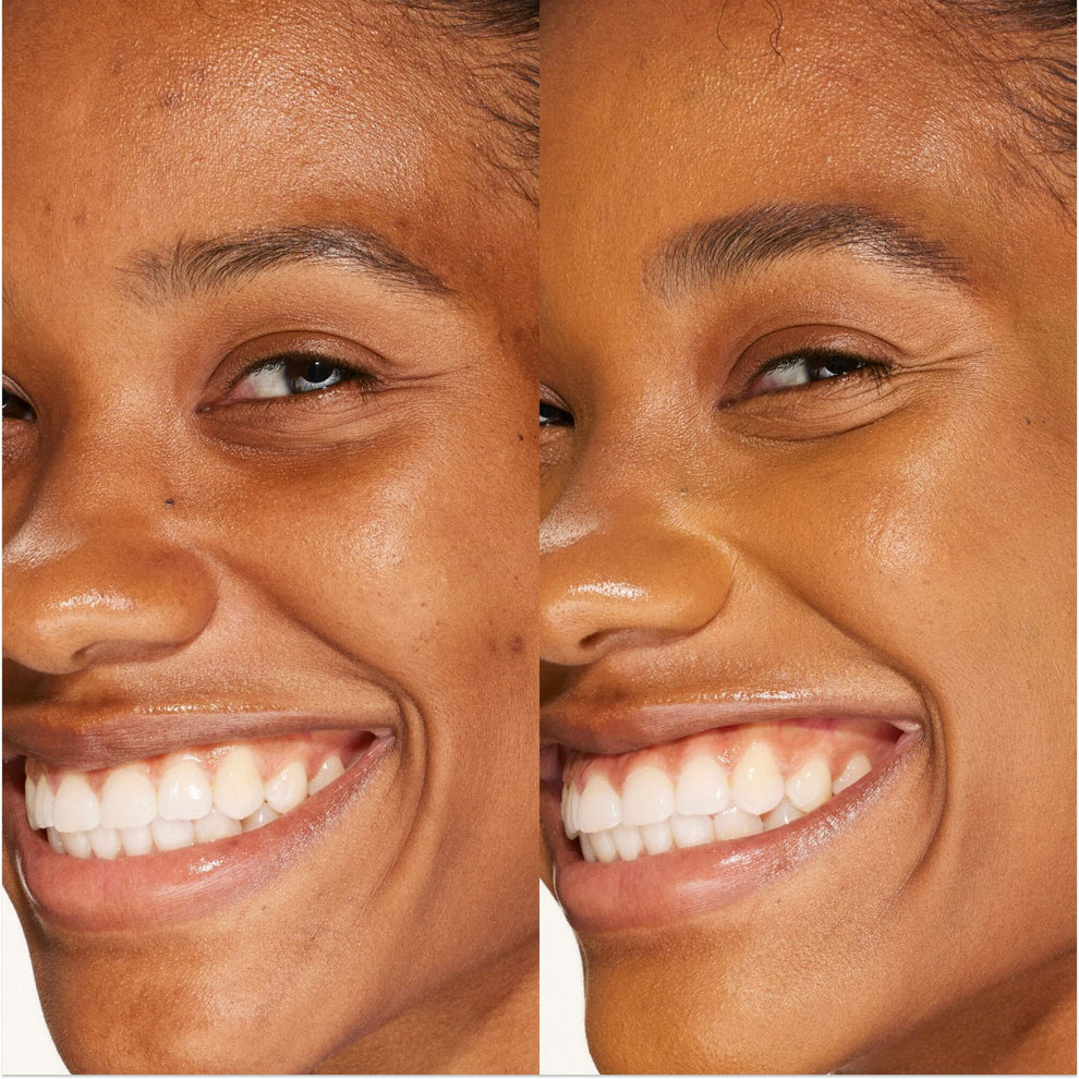 A person's face before and after using Tower 28 Beauty's Swipe Serum Concealer in shade 14.0 PV to cover up dark circles, blemishes, and discoloration