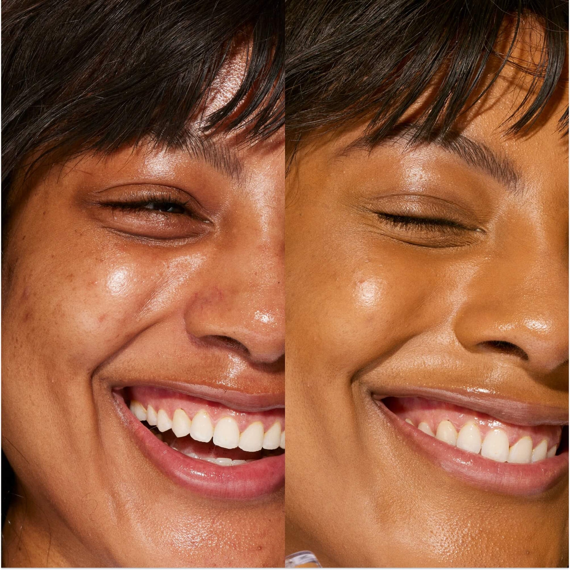 A person's face before and after using Tower 28 Beauty's Swipe Serum Concealer in shade 14.0 PV to cover up dark circles, blemishes, and discoloration