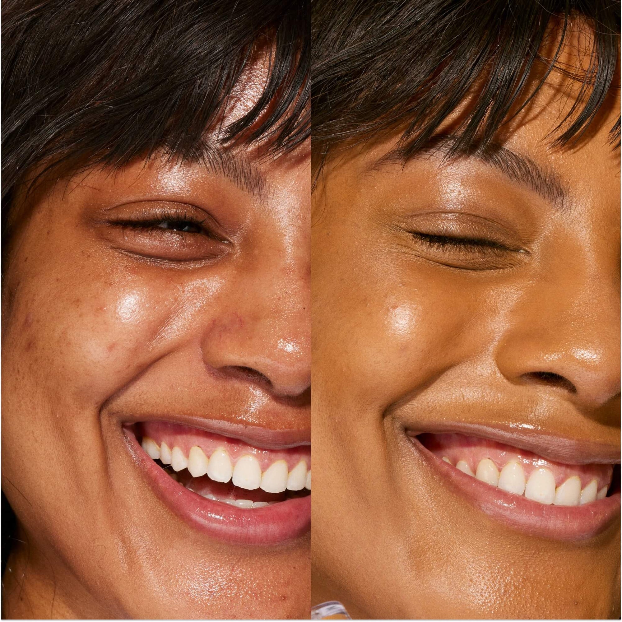A person's face before and after using Tower 28 Beauty's Swipe Serum Concealer in 14.0 PV, shown with visibly evened skin tone, smooth texture, and a soft matte finish. [14.0 PV]