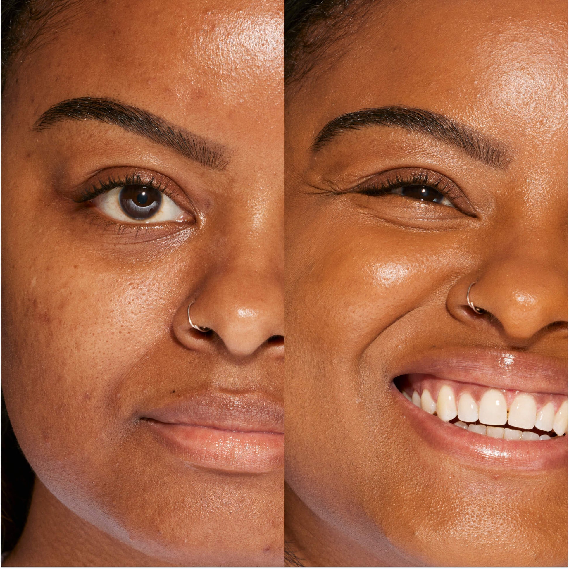 A person's face before and after using Tower 28 Beauty's Swipe Serum Concealer in shade 15.0 SAMO to cover up dark circles, blemishes, and discoloration