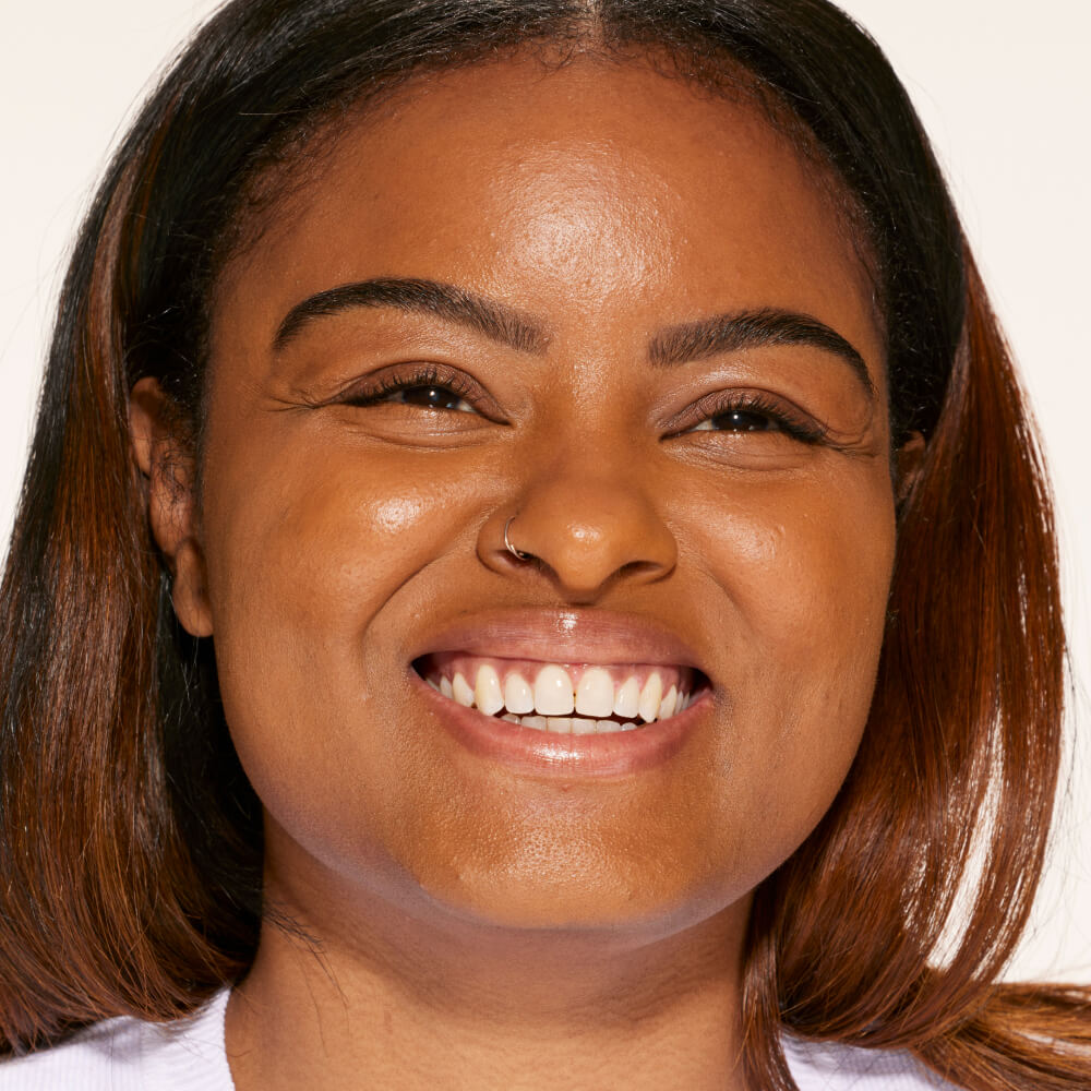 A person's face with an evened out complexion after using Tower 28 Beauty's Swipe Serum Concealer in shade 15.0 SAMO. [15.0 SAMO]