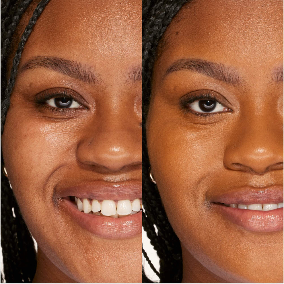 A person's face before and after using Tower 28 Beauty's Swipe Serum Concealer in shade 15.0 SAMO to cover up dark circles, blemishes, and discoloration